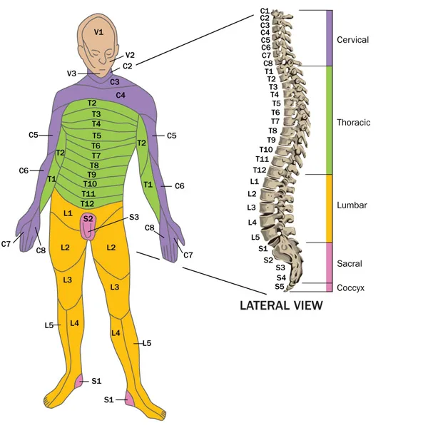 The illustrated diagram provides a colour coded overview of the general areas affected by the location of the SCI