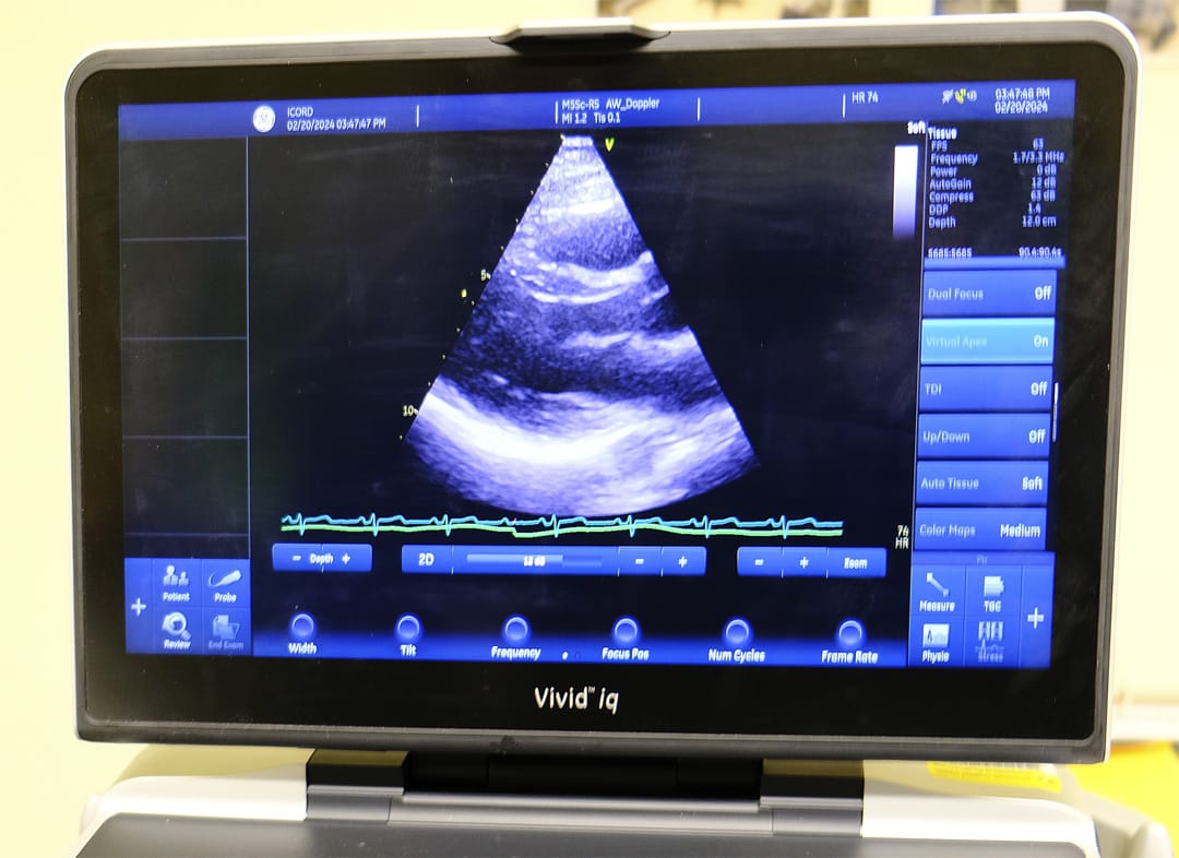 Ultrasound heart scan of a participant.